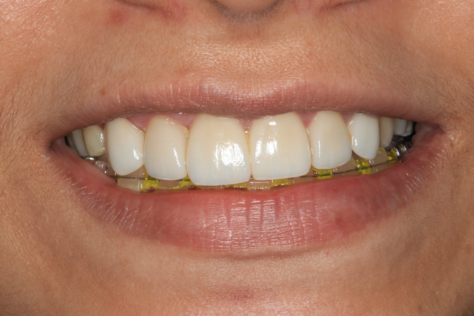 WhatsApp Image 2026-02-03 at 1.32.39 PM