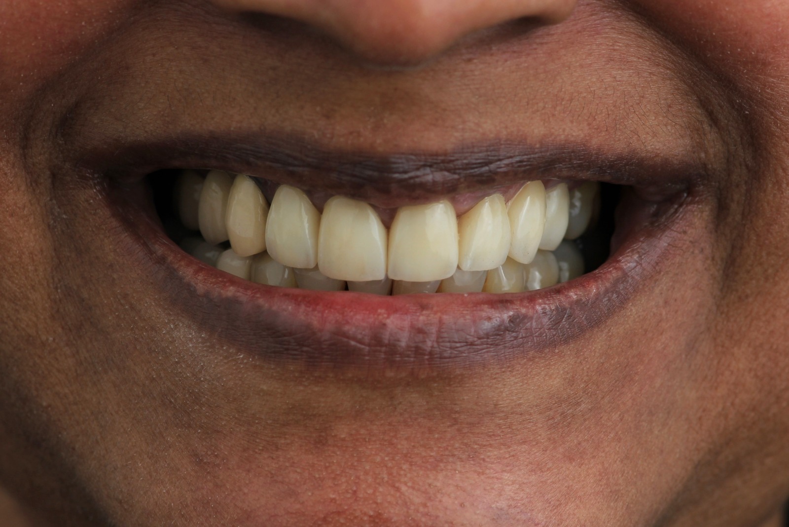 WhatsApp Image 2026-02-03 at 1.32.40 PM (3)