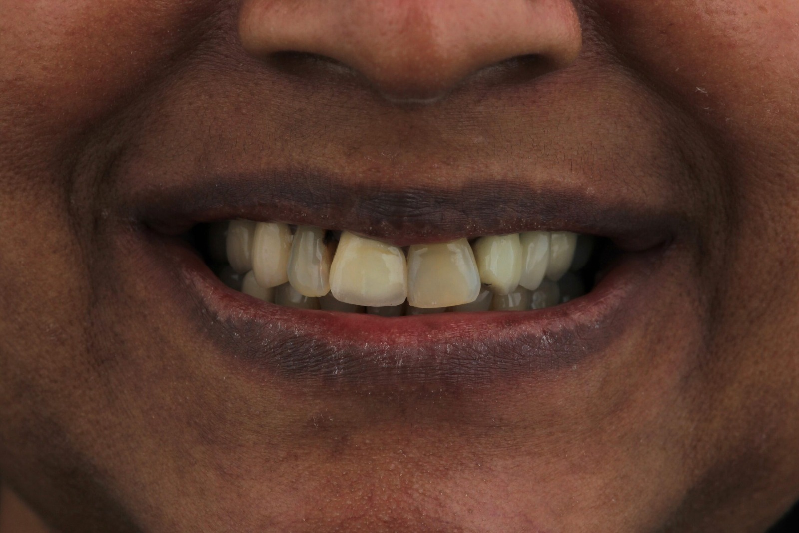 WhatsApp Image 2026-02-03 at 1.32.40 PM (4)